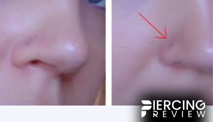 sinking nose piercing before and after comparison pictures