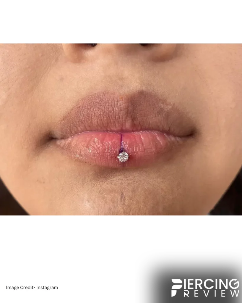 ashley piercing picture while surgery