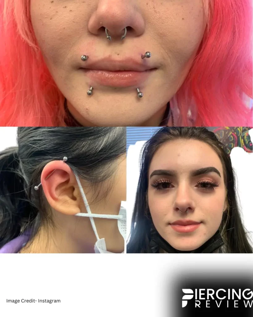 women image before and after -Canine Bites Piercing