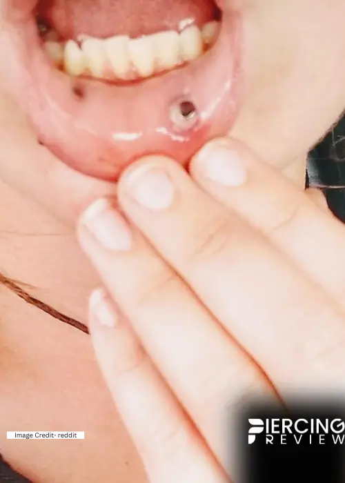 lip piercing infection inside mouth