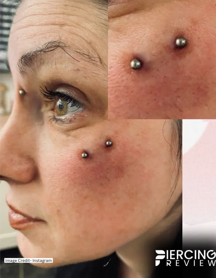 Dealing with an Infected Anti-Eyebrow Piercing